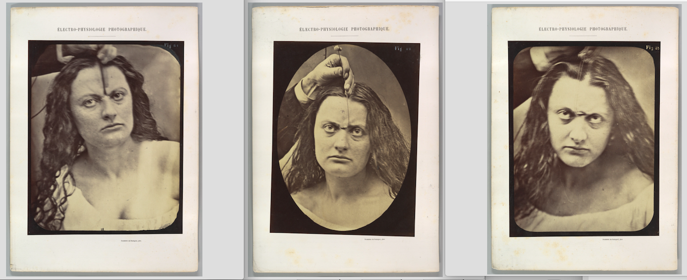 Guillaume-Benjamin-Amand Duchenne de Boulogne & Adrien Tournachon, 1854-56, printed 1862, albumen silver prints from glass negatives, 28.4 × 20.3 cm. Plate 81: “Lady Macbeth, moderate expression of cruelty”: “Lady Macbeth: Had he not resembled // My father as he slept, I had done’t. [Macbeth, act II, scene II]. Moderate expression of cruelty. Feeble electrical contraction of the m. procerus (P, Fig. 1)” Plate 82: “Lady Macbeth, strong expression of cruelty”: “Lady Macbeth: Come, you spirits // That tend on mortal thoughts, unsex me here, // And fill me, from crown to the toe, top-full // Of direst cruelty. [Macbeth, act I, scene V] Strong expression of cruelty. Electrical contraction of m. procerus.” Plate 83: “Lady Macbeth, ferocious cruelty”: “Lady Macbeth - about to assassinate King Duncan. Expression of ferocious cruelty. Maximal electrical contraction of m. procerus.” Metropolitan Museum of Art, Purchase, The Buddy Taub Foundation Gift, Dennis A. Roach and Jill Roach, Directors; Harris Brisbane Dick and William E. Dodge Funds; and W. Bruce and Delaney H. Lundberg Gift, 2013. https://www.metmuseum.org (Public Domain)